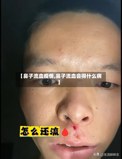 【鼻子流血疫情,鼻子流血会得什么病】-第3张图片
