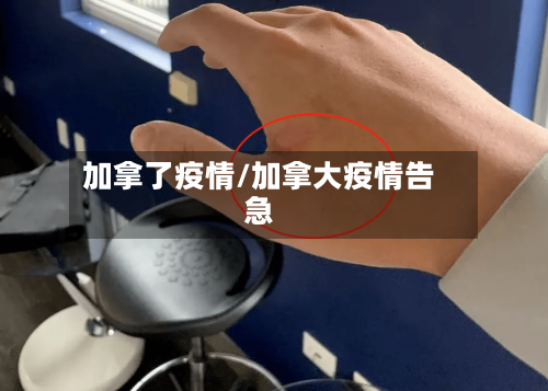 加拿了疫情/加拿大疫情告急-第1张图片