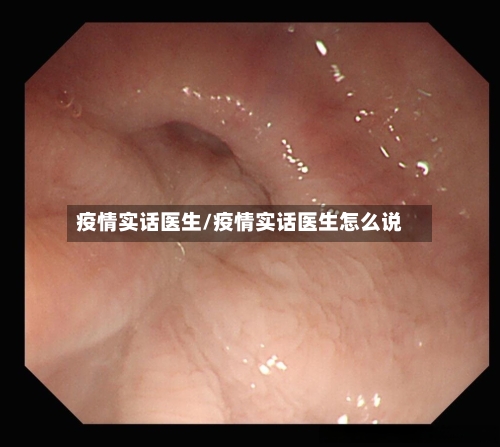 疫情实话医生/疫情实话医生怎么说-第1张图片